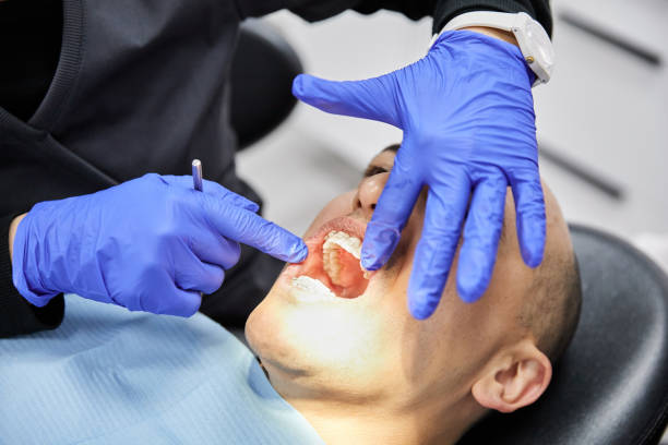 Best Emergency Gum Treatment in Lealman, FL